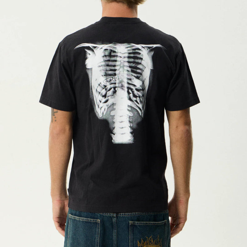 Person wearing a black t-shirt with a white graphic of a ribcage on the back, standing against a plain background.